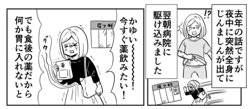 あまりの痒さでバイオハザード化　じんましんが辛すぎた漫画家、無意識のうちに「あの言葉」を口走っ…