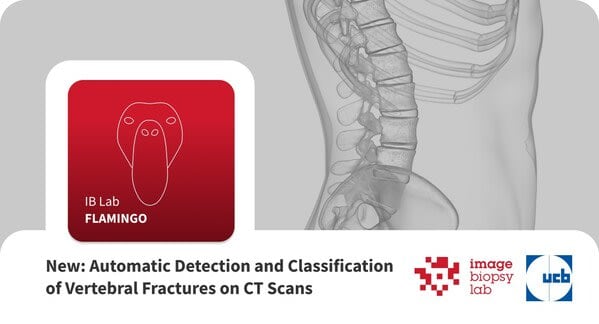 AI innovation to automatically detect and classify osteoporotic vertebral fractures in CT scans – ImageBiop…