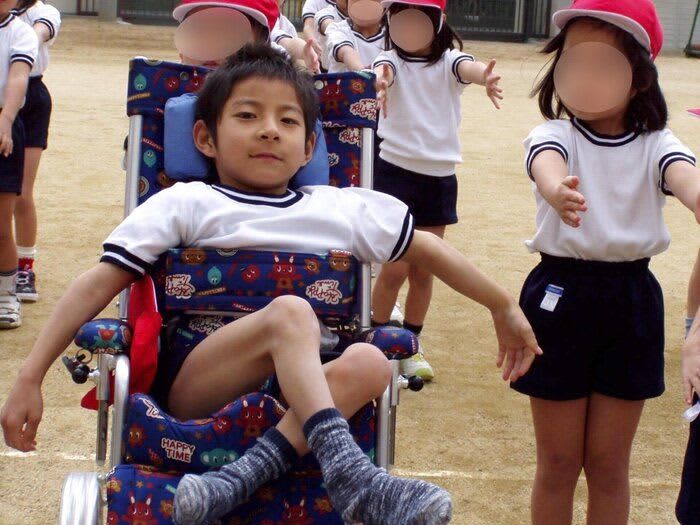 Diagnosed with cerebral palsy at XNUMX months old.Can't laugh!? Can't walk!? "I might kill this child..."