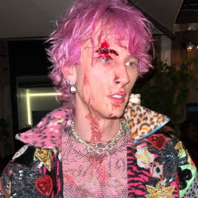 Machine Gun Kelly Says He Smashed a Champagne Glass on His Forehead