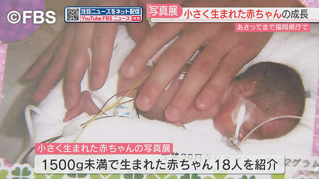 『小さく生まれた赤ちゃん』成長の軌跡　福岡県庁で写真展始まる