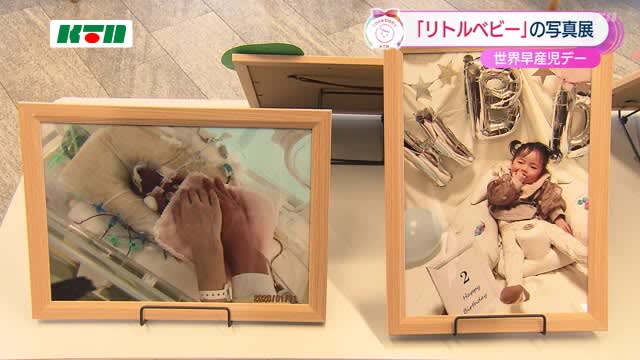 世界早産児デーにあわせ長崎県庁で「リトルベビー」の写真展